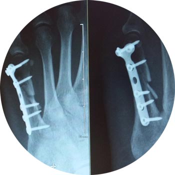 x-ray-924237
